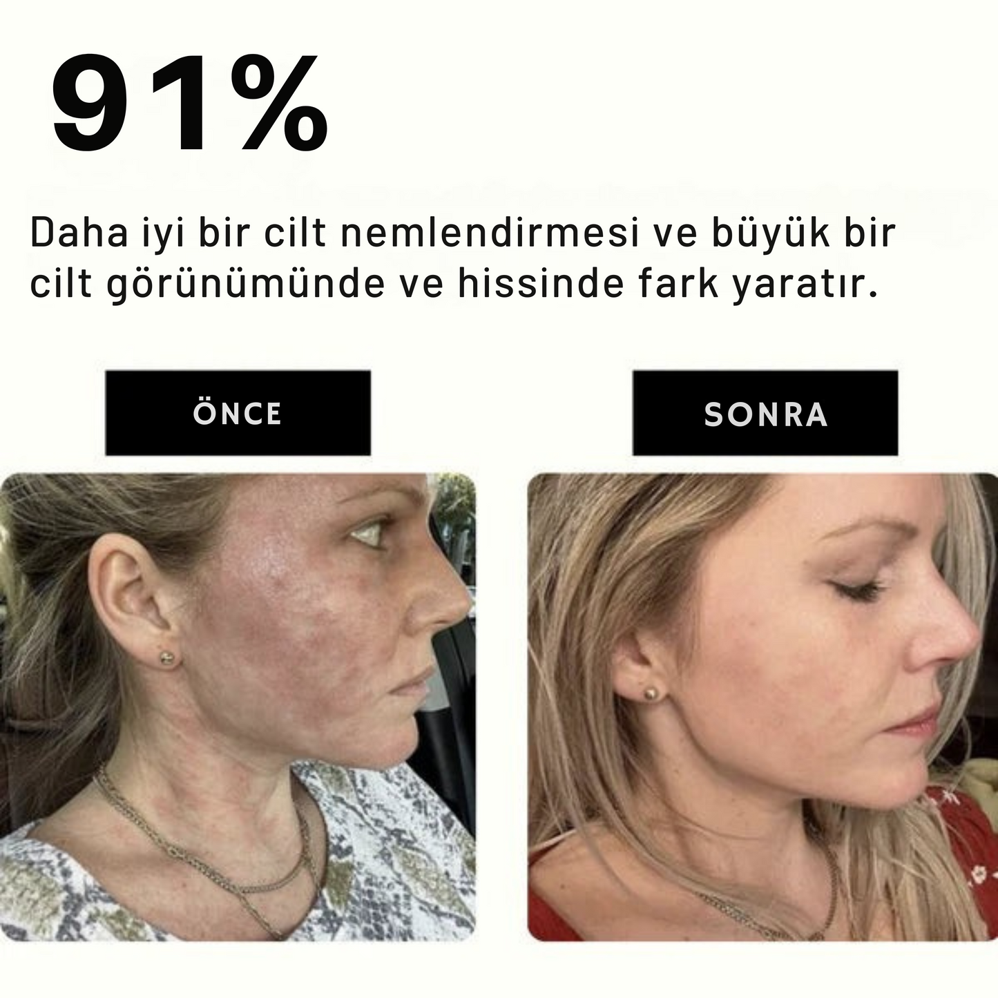 Filtrevia™ Filtreli Duş Başlığı