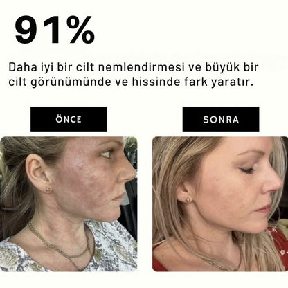 Filtrevia™ Filtreli Duş Başlığı