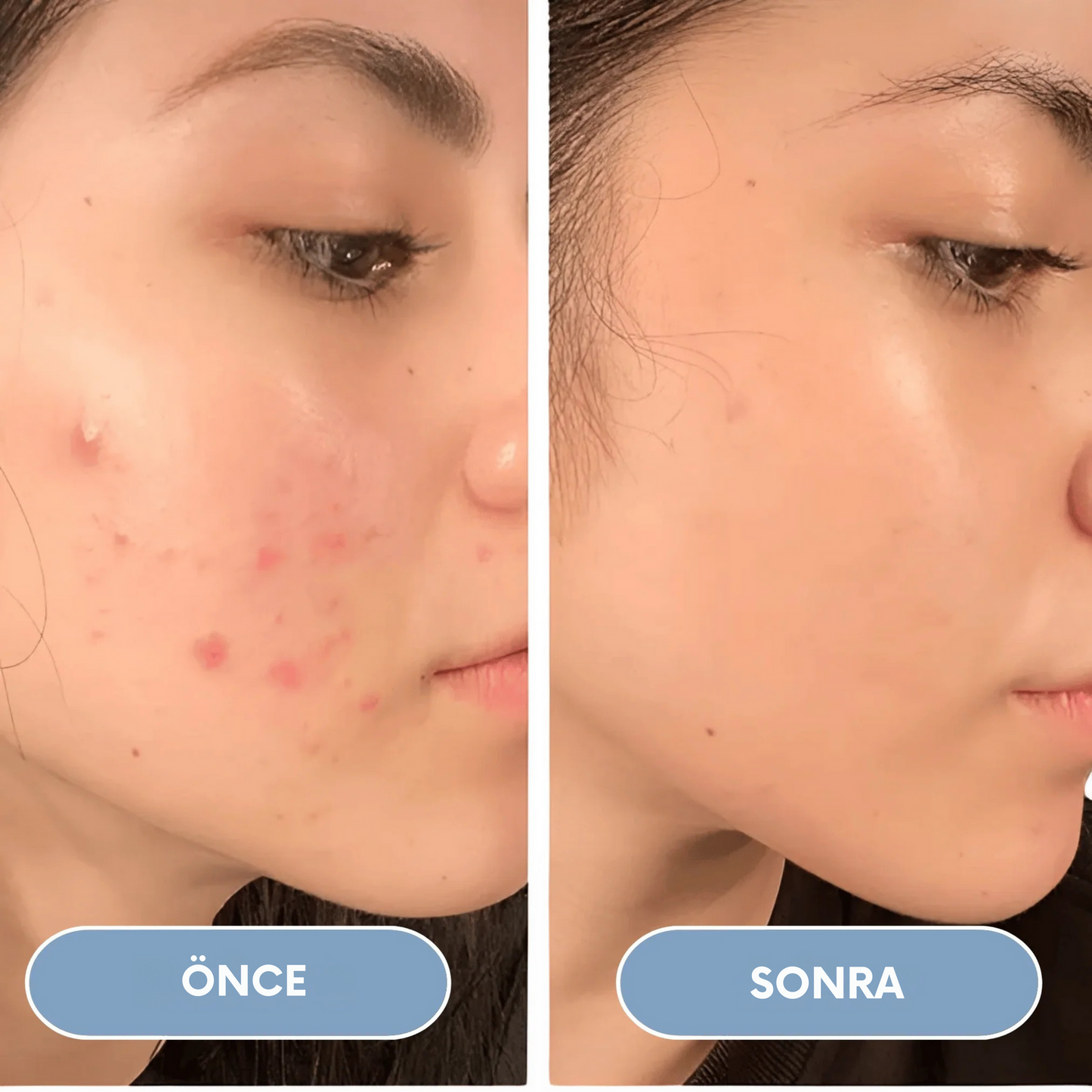 Filtrevia™ Filtreli Duş Başlığı